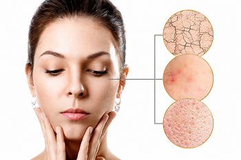 skin-image